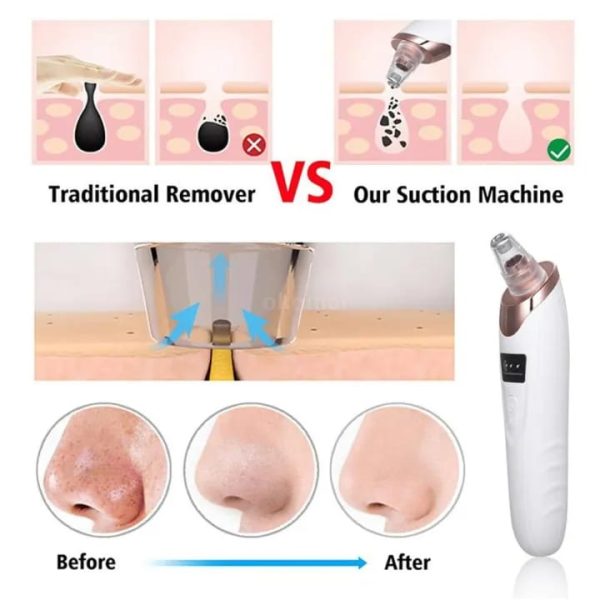Blackhead Remover Vacuum Acne Cleaner
